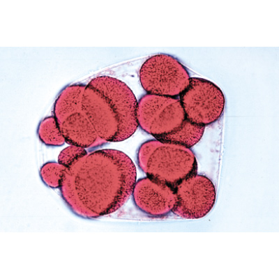 Embryologie de l’oursin de mer (Psammechinus miliaris) - Espagnol, 1003947 [W13026S], Préparations microscopiques LIEDER