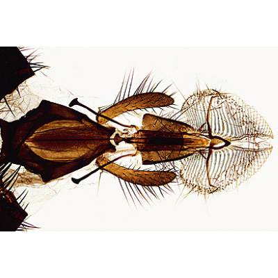 Insectes, série élémentaire grossie - Anglais, 1003965 [W13035], Lames microscopiques Anglais