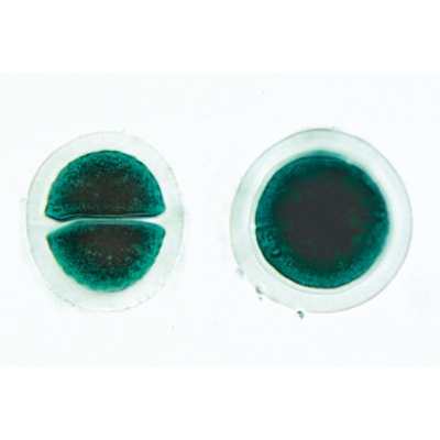 Algues - Anglais, 1003970 [W13041], Préparations microscopiques LIEDER
