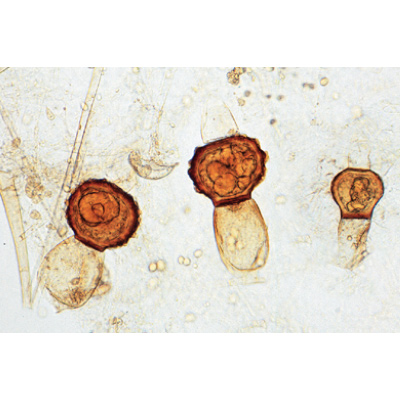 Champignons et lichens - Anglais, 1003971 [W13042], Lames microscopiques Anglais