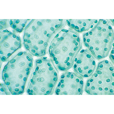 Bryophytes (sphaignes et mousses) - Anglais, 1003972 [W13043], Préparations microscopiques LIEDER