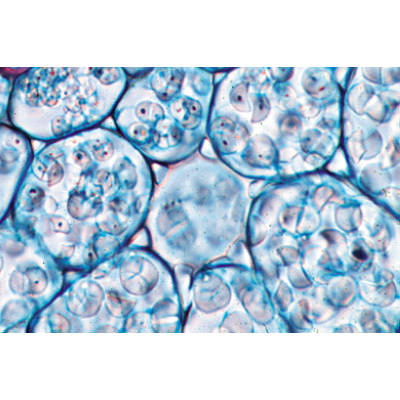 Angiospermes, racines - Anglais, 1003976 [W13047], Préparations microscopiques LIEDER