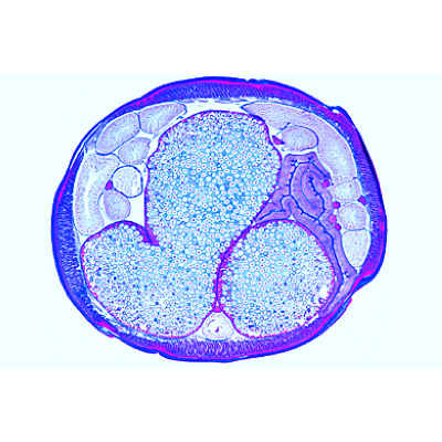 The Ascaris megalocephala Embryology - German, 1013478 [W13084], Préparations microscopiques LIEDER