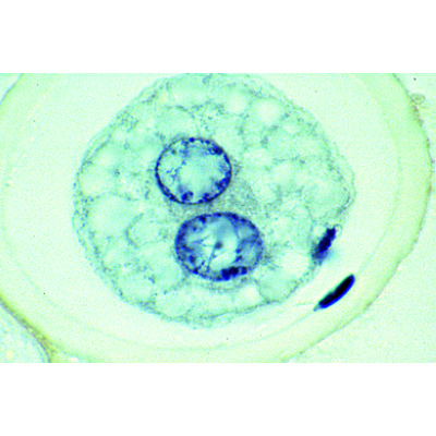 Maturation et clivage de l’Ascaris (Ascaris megalocephala bivalens), 1013480 [W13085], Préparations microscopiques LIEDER