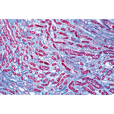 Pathologie humaine série de base - Espagnol, 1004097 [W13311S], Préparations microscopiques LIEDER