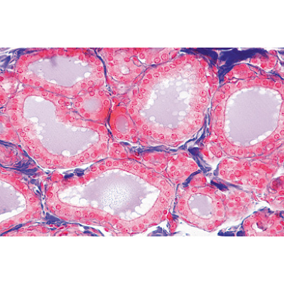 Système endocrine - Allemand, 1004118 [W13317], Lames microscopiques Allemand