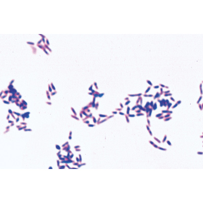 Bactéries pathogènes - Allemand, 1004146 [W13324], Préparations microscopiques LIEDER