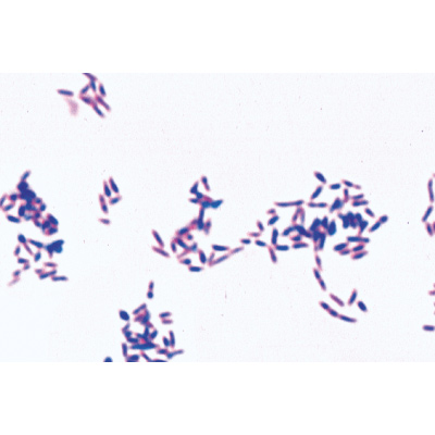 Bactéries pathogènes - Portugais, 1004148 [W13324P], Préparations microscopiques LIEDER