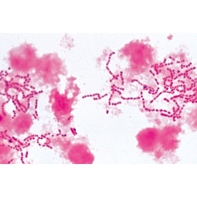 Bactéries pathogènes - Espagnol, 1004149 [W13324S], Préparations microscopiques LIEDER