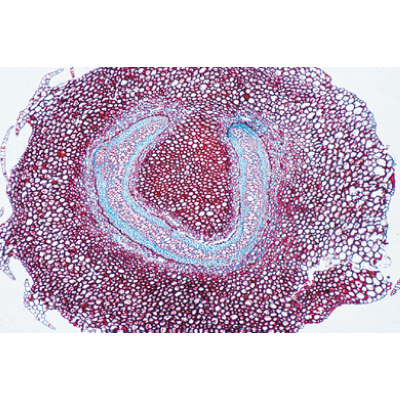 Disposition et types de paquets vasculaires - Allemand, 1004170 [W13330], Préparations microscopiques LIEDER