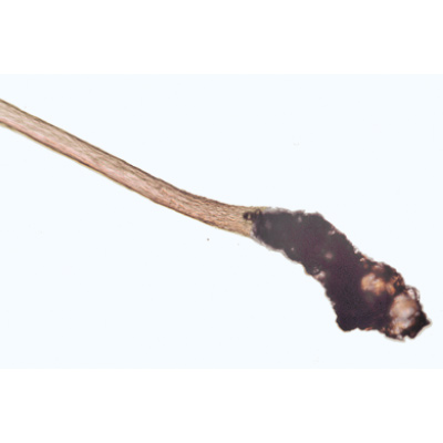 Structure fine du cuir chevelu, cheveux sains et malades - Allemand, 1004221 [W13343], Préparations microscopiques LIEDER