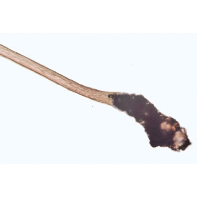 Structure fine du cuir chevelu, cheveux sains et malades - Portugais, 1004223 [W13343P], Préparations microscopiques LIEDER