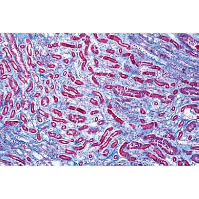 Pathologie humaine série de base - Anglais, 1004236 [W13411], Préparations microscopiques LIEDER