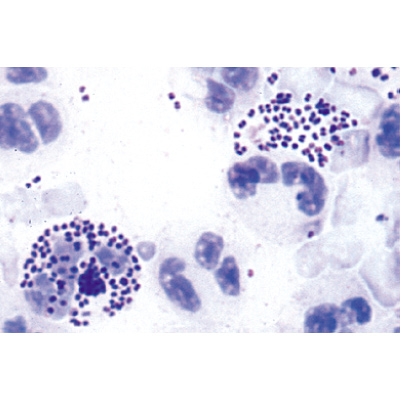 Bactéries pathogènes - Anglais, 1004249 [W13424], Préparations microscopiques LIEDER