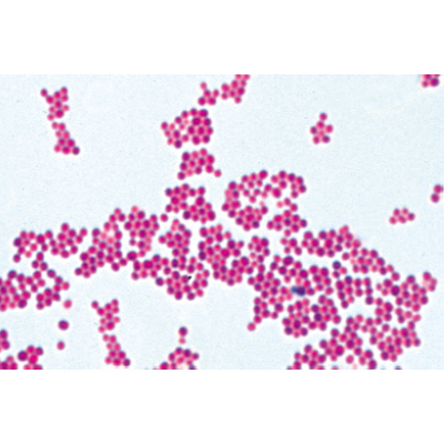 Bactéries pathogènes - Anglais, 1004249 [W13424], Lames microscopiques Anglais