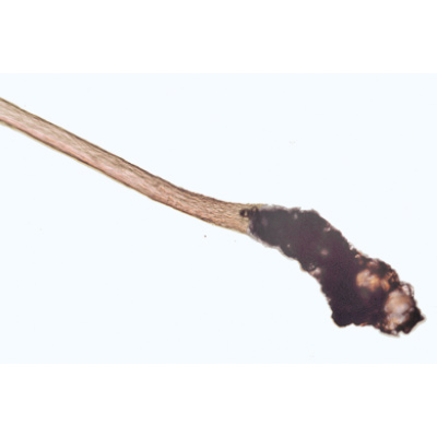 Structure fine du cuir chevelu, cheveux sains et malades - Anglais, 1004268 [W13443], Lames microscopiques Anglais