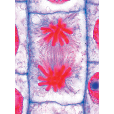 MULTIMÉDIA POUR L’ENSEIGNANT Mitose et méiose (division cellulaire) Série de base de 6 unités, 1004353 [W13741], Lames microscopiques Allemand