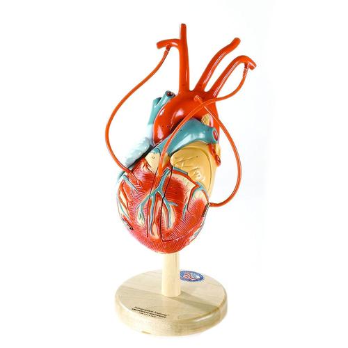 The NEW Heart of America PLUS with Coronary Bypass Vessels, 1018273 [W42571], Modèles cœur et circulation