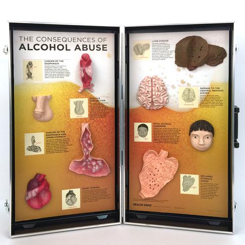 « Les consêquences de l'alcoolisme », panneau 3D, 1005582 [W43053], Prévention drogues et alcools