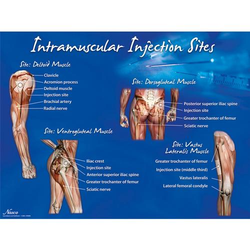 Affiche des sites d’injection intramusculaire, 1018427 [W44783], Injection et ponction