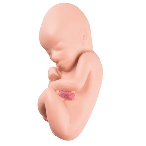 Fœtus de rechange pour L10/4, 1018629 [XL002], Pièces de rechange
