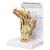 Modèle de main avec arthrite rhumatoïde, 1019521, Squelettes des membres supérieurs (Small)