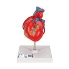 Cœur classique avec pontage, en 2 parties - 3B Smart Anatomy, 1017837 [G05], Éducation Santé du Coeur et Fitness