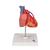 Cœur classique avec pontage, en 2 parties - 3B Smart Anatomy, 1017837 [G05], Éducation Santé du Coeur et Fitness (Small)