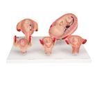 Série de grossesse 3B Scientific®, 
5 modèles - 3B Smart Anatomy, 1018633 [L11/9], Homme