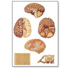 Le système nerveux central humain, 4006536 [V2034U], Planches anatomiques