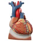 Cœur sur diaphragme, agrandi 3 fois, en 10 parties - 3B Smart Anatomy, 1008547 [VD251], Modèles cœur et circulation
