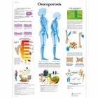 Osteoporosis, 1001803 [VR3121L], Éducation Arthrite et Ostéoporose