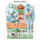 Diabetes mellitus, 4006857 [VR3441UU], Système métabolique