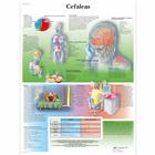 Cefaleas, 1001933 [VR3714L], Cerveau et système nerveux