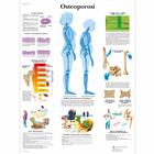 Osteoporosi, 4006898 [VR4121UU], Éducation Arthrite et Ostéoporose