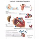 Malattie cardiache frequenti, 4006928 [VR4343UU], Éducation Santé du Coeur et Fitness