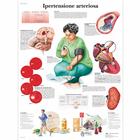 Ipertensione arteriosa, 1002033 [VR4361L], système cardiovasculaire