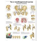 Медицинский плакат "Таз и тазобедренный сустав, анатомия и патология", 1002228 [VR6172L], système Squelettique