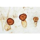 Champignons et lichens - Français, 1003893 [W13013F], Lames microscopiques Français