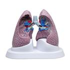Jeu de poumons avec pathologies, 1018749 [W33371], Modèles de poumons